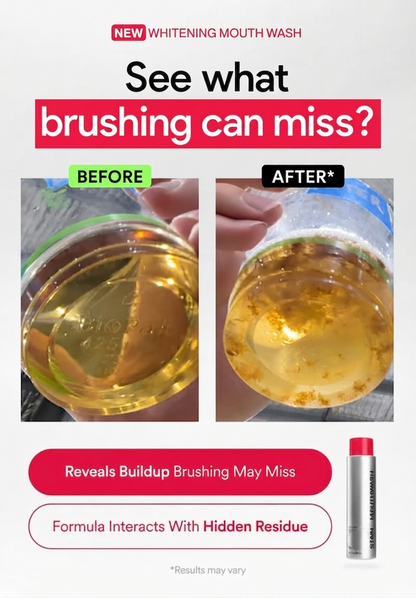 iD Stain Whitening Mouthwash