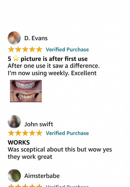 V34 Whitening Strips